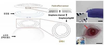 Graphene lens sensor for disease monitoring image